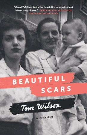 Beautiful Scars by Tom Wilson: 9780385685672 | PenguinRandomHouse.com: Books