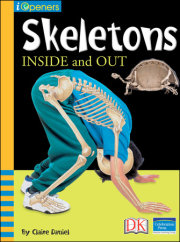 iOpener: Skeletons Inside and Out
