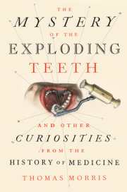 The Mystery of the Exploding Teeth 